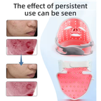 8-Color Light Therapy Mask